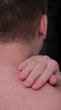 Close-up view of a man's hand touching and examining a large red atheroma, an inflamed sebaceous cyst or lipoma, located on his upper back, showing a concerning skin problem. Vertical video