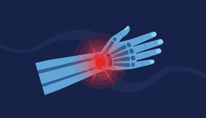 Illustration of a blue human hand and wrist with a bright red area indicating acute pain or inflammation, set against a dark blue background with subtle wavy lines, symbolizing medical discomfort and