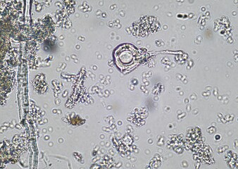 soil microorganisms under a microscope including amoeba, flagellates, nematodes, fungi, bacteria  © ADP