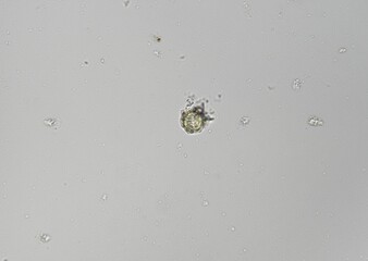 soil microorganisms under a microscope including amoeba, flagellates, nematodes, fungi, bacteria	