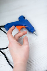 Burn Blister on Finger Caused by Hot Glue Gun Accident