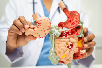Digestive system with stomach and intestine, Asian doctor holding human anatomy model for study...