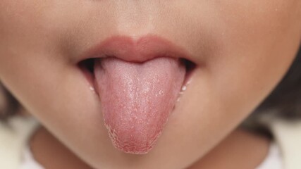 Anterior Tongue Close-Up of a child for Pediatric Oral Health Education