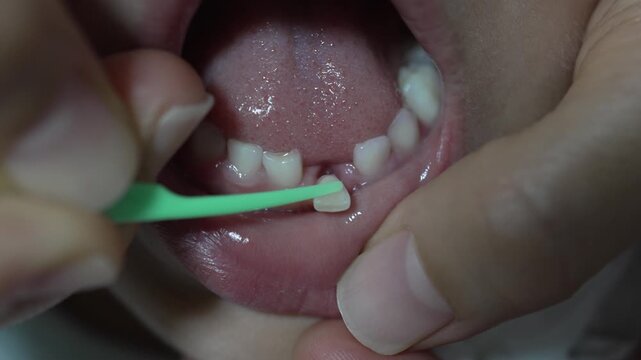 Primary Tooth in Child will soon fall out for Dental Health Education 2