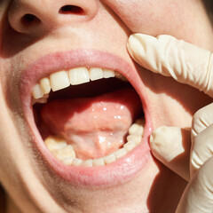 Fototapeta premium Close-up of female patients open mouth with gloved hand during oral examination for dental health check-up.