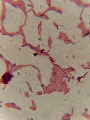 A compound microscope view shows a dense field of rod-shaped (bacillus) bacterial cells clustered on a slide