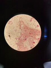 A compound microscope view shows a dense field of rod-shaped (bacillus) bacterial cells clustered on a slide