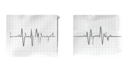 2. Electrocardiogram Graph Line on Medical Paper, isolated on transparent background