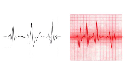 1. ECG Heartbeat Tracing with Regular Sinus Rhythm, isolated on transparent background