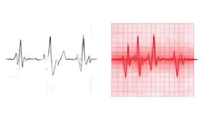 1. ECG Heartbeat Tracing with Regular Sinus Rhythm, isolated on transparent background