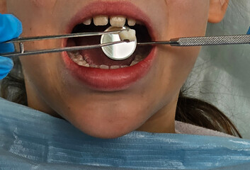 Child receiving dental care with tools in a clinic setting