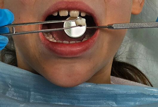 Child receiving dental care with tools in a clinic setting