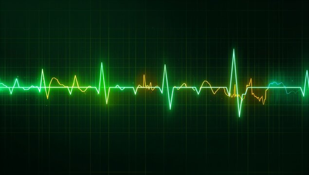 Displaying multicolored ECG waveform pulsing across medical monitor interface, with neon grid lines