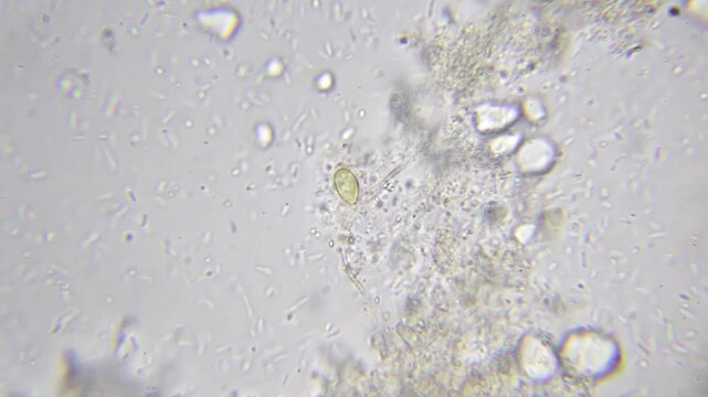 Bacteria colony and fungal hypha under a microscope at 2000x magnification with immersion oil