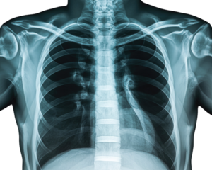 Human chest x ray medical imaging isolated on transparent background