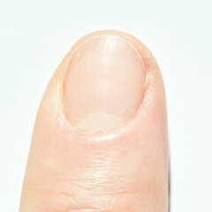 Fototapeta premium Close-up of caucasian adult fingernail highlighting cuticle and nail texture.