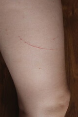 Woman’s lower leg with a fresh scratch caused by a cat. Indoor lighting, wooden floor background....