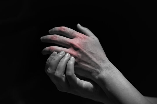 Close up of woman massage fingers to relive pain, arthritis treatment , gout, rheumatoid symptoms and chronic illness health care concept