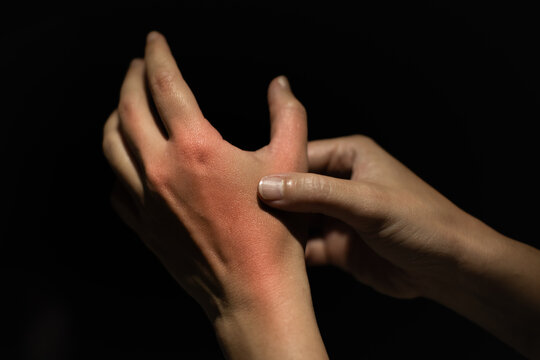 Close up of woman massage fingers to relive pain, arthritis treatment , gout, rheumatoid symptoms and chronic illness health care concept