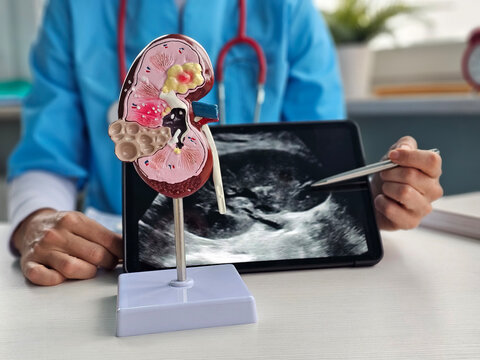 Medical professional explains kidney function using a model and tablet display at a healthcare facility