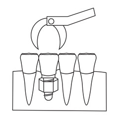 Dental Implant Procedure for Front Teeth glyph icon