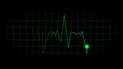 Cyan digital waveform displayed over black grid forming sleek line graph for modern data visualization. Green electrocardiogram waveform with glowing dot on a black grid background heart rate. - Powered by Adobe