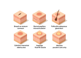 isometric icon items isolated on white background skin infection epidermal stratum corneum breach skin infection dermal papillary microcirculation skin infection folliculitis sebaceous