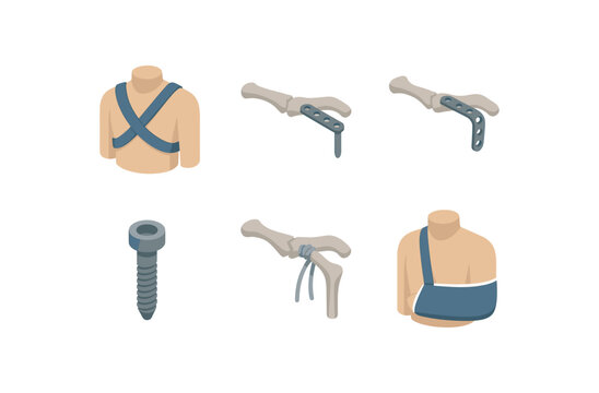 isometric icon items isolated on white background clavicular fracture figure of eight brace clavicular fracture midshaft plate clavicular fracture hook plate clavicular fracture locking