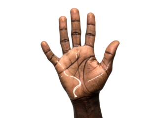Close-up of an open dark-skinned palm, showing lifeline, heart line, and head line. Black background with strong contrast
