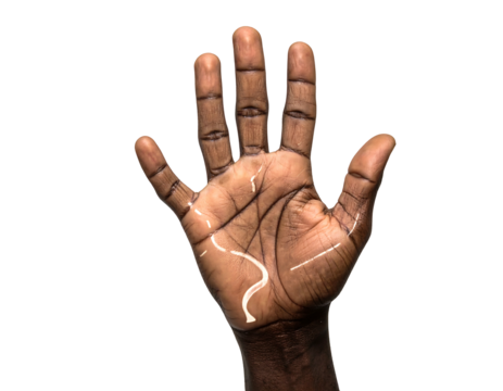 Close-up of an open dark-skinned palm, showing lifeline, heart line, and head line. Black background with strong contrast