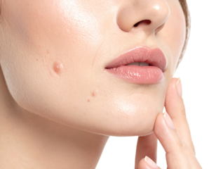 Close-up on a woman's face, focusing on skin texture and minor blemishes. Hand touching cheek