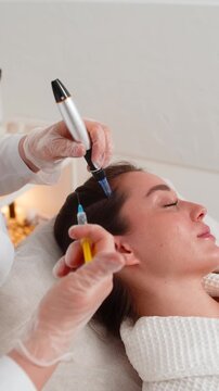 Alopecia. Woman hair loss treatment regeneration. Trichologist cosmetologist doctor applies vitamin serum injections from a syringe on head scalp dermapen fractional microneedle clinic mesotherapy