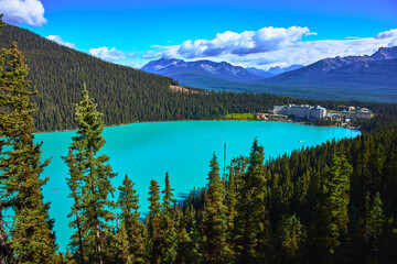 Lake Louise Turquoise Water Mountain Forest and Iconic Hotel in Summer