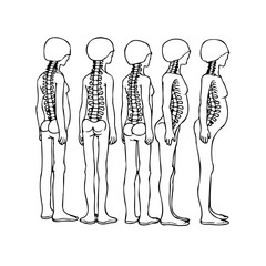 Variations in spinal alignment: A comparative study of skeletal structures and postural