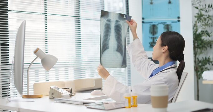Asian female doctor examines MRI film in clinic, reviewing patient data and medical imaging for diagnosis. Professional healthcare, radiology analysis, spine or neurological check, treatment planning.
