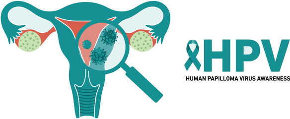 Illustrative Uterus Displaying HPV Infection for Sexual Health Awareness Campaign: Medical Education Visual for Gynecological Health, Promoting Disease Prevention & Vaccination Advocacy, Using Teal Co