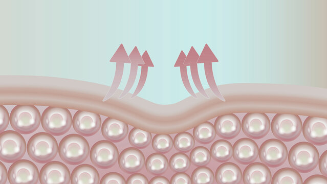 Skin Repair and Lifting Process with Dermal Structure