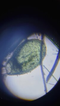 Vertical, extreme close-up shot taken through a microscope, showing a large, transparent, ovoid or teardrop-shaped biological structure, potentially a bladder from an aquatic plant like Utricularia