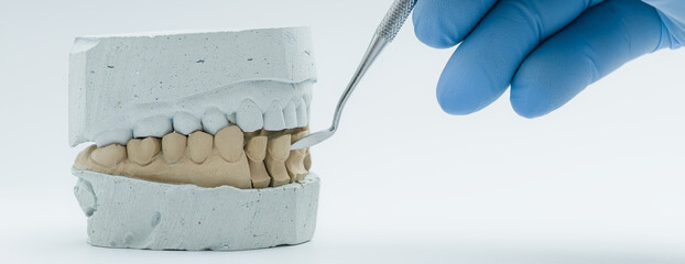 Dental technician working on plaster tooth model