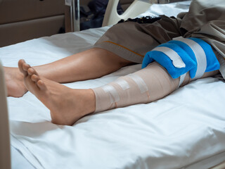 Patient resting in hospital bed after ACL knee surgery, leg wrapped with compression bandage and cold pack. Concept of orthopedic surgery recovery, rehabilitation, and post-operative care.