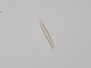 Gyrosigma sp. diatom under brightfield microscope at 20x0.50 magnification