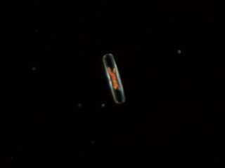 Navicula sp. diatom under darkfield microscope at 20x0.50 magnification