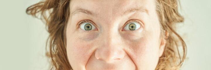 Caucasian female adult with wide green eyes and curly hair expressing surprise close-up.