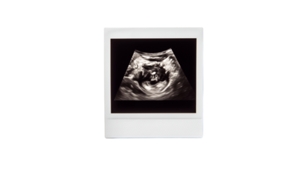 Expecting a new arrival during an ultrasound session in a doctor's office Generative AI