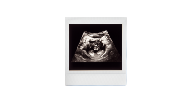 Expecting a new arrival during an ultrasound session in a doctor's office Generative AI