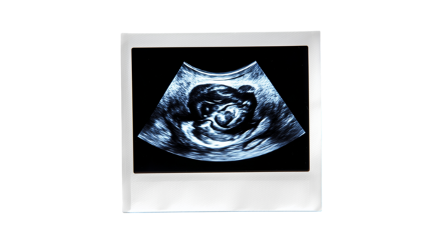 Expecting a new life with this ultrasound image showing a developing baby in the womb during the early stages of pregnancy Generative AI