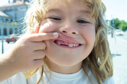 Portrait of funny kid with open mouth without front milk tooth. Loss primary teeth. Growth of permanent molar baby tooth. Child missing tooth.