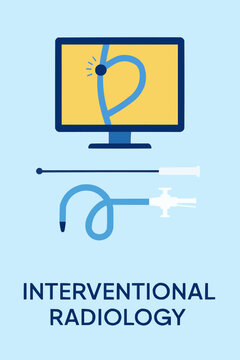 Flat vector of interventional radiology kit with catheter, guidewire, and imaging monitor