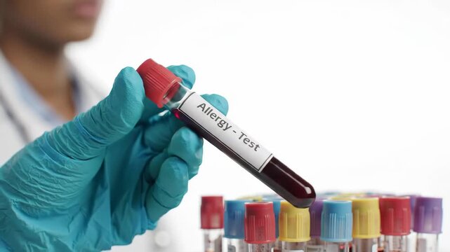 Gloved Hand Holding Allergy Test Tube with Blood Samples in White Background