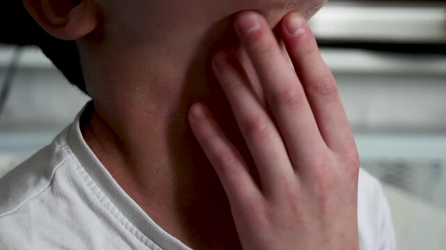 Atopic dermatitis on a child's neck, scratching itchy skin with hands